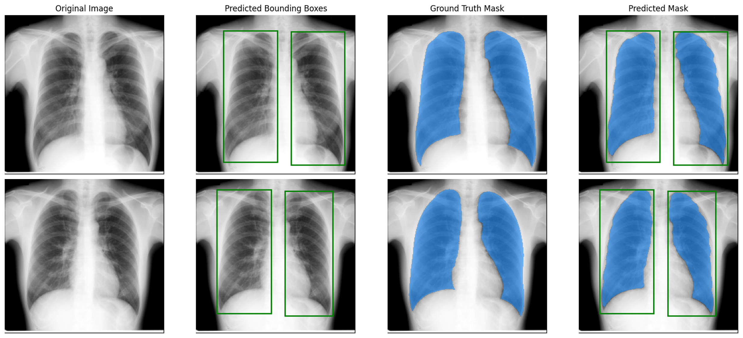 YOLOv8 与 SAM 动态提示流水线
