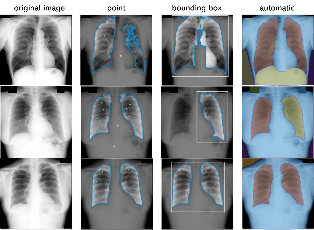 SAM Web Demo 分割体验