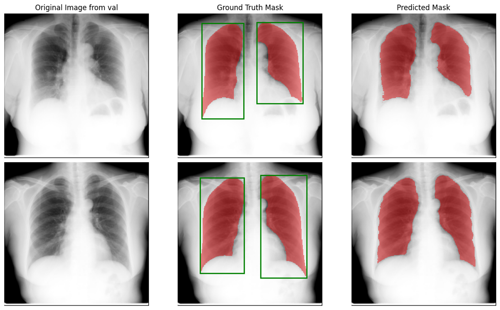真实边界框提示分割结果